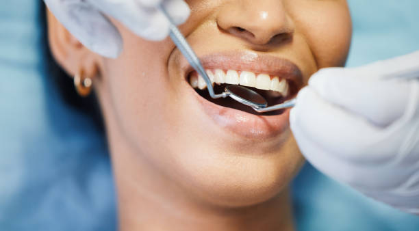 Best Emergency Cosmetic Dentistry in Long View, NC
