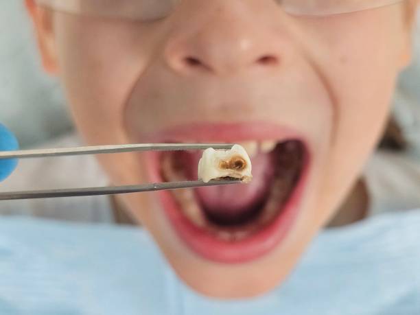 Best Pediatric Emergency Dentist in Long View, NC